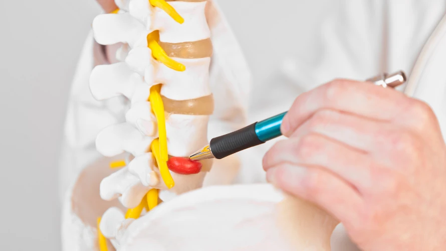 Disc Herniation: How Chiropractic Treatment and Soft Tissue Mobilization Can Help