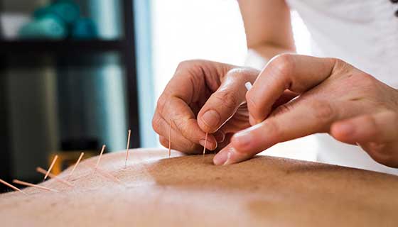 The Healing Power of Acupuncture