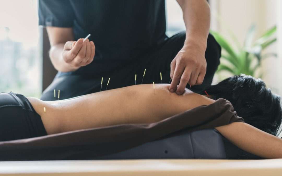 Combining Chiropractic Care and Acupuncture for Enhanced Healing