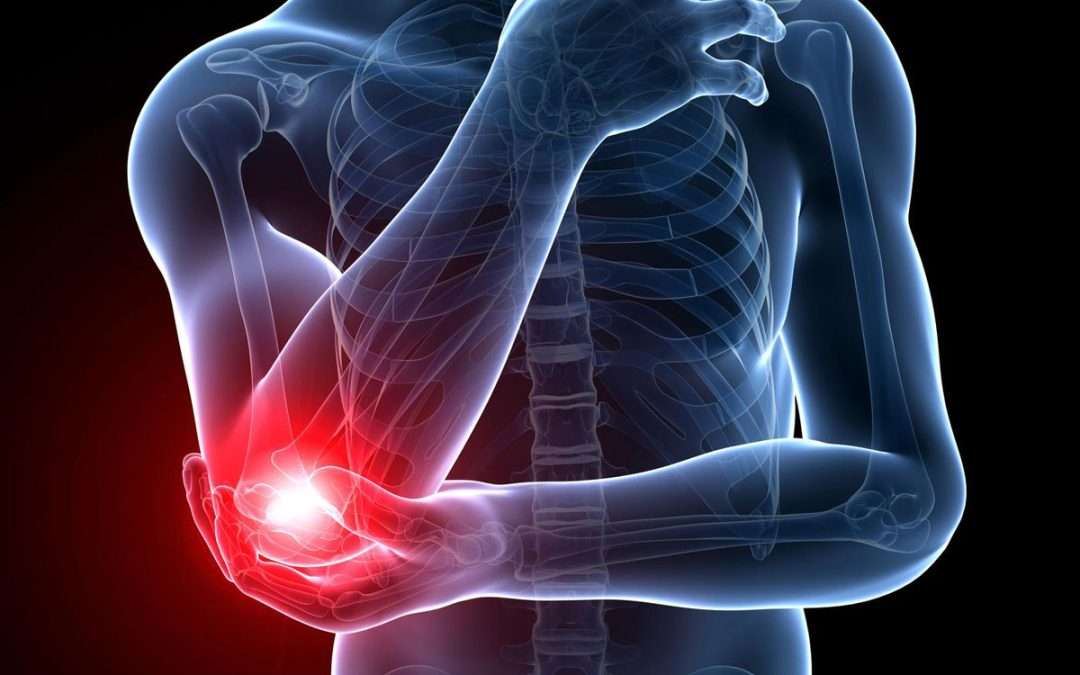 Unraveling the Mysteries of Elbow Pain: A Chiropractic Perspective from SF Custom Chiropractic