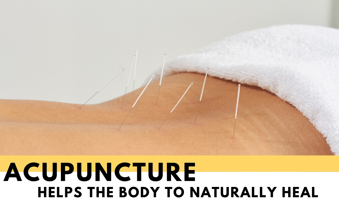 Acupuncture for Sciatica: How and Why