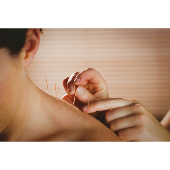 Does Getting Acupuncture Hurt?